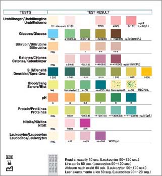 Diastix Reagent Strips For Urinalysis Color Chart