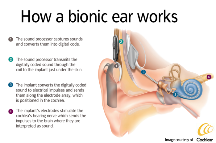 Bionic Ear at emaze Presentation