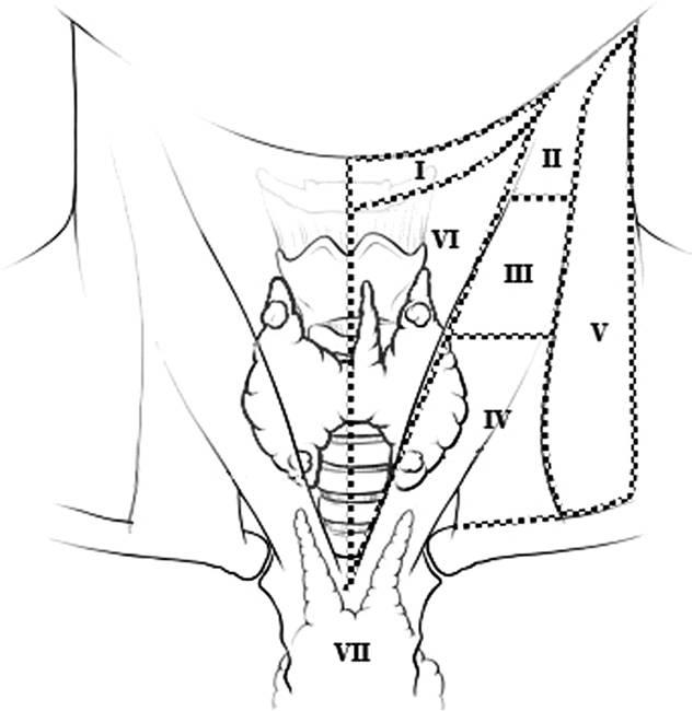 7 levels of lymph nodes in neck 7 levels of lymph nodes in neck