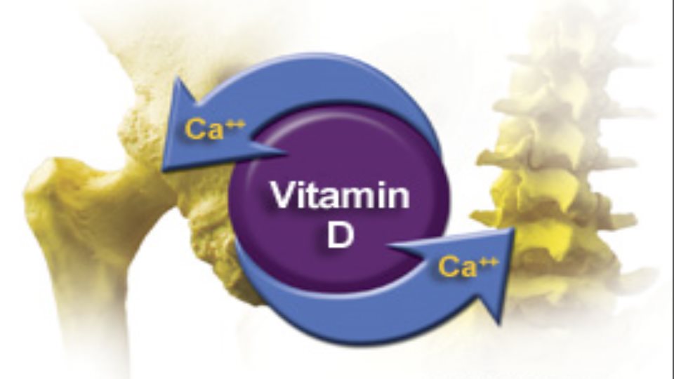 Artrosis y vitamina d