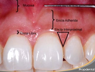 Integridad de la mucosa y dientes