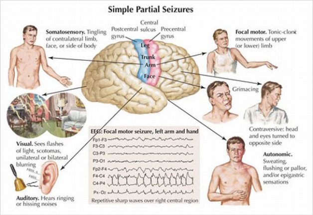 Treatment of epilepsy in adults