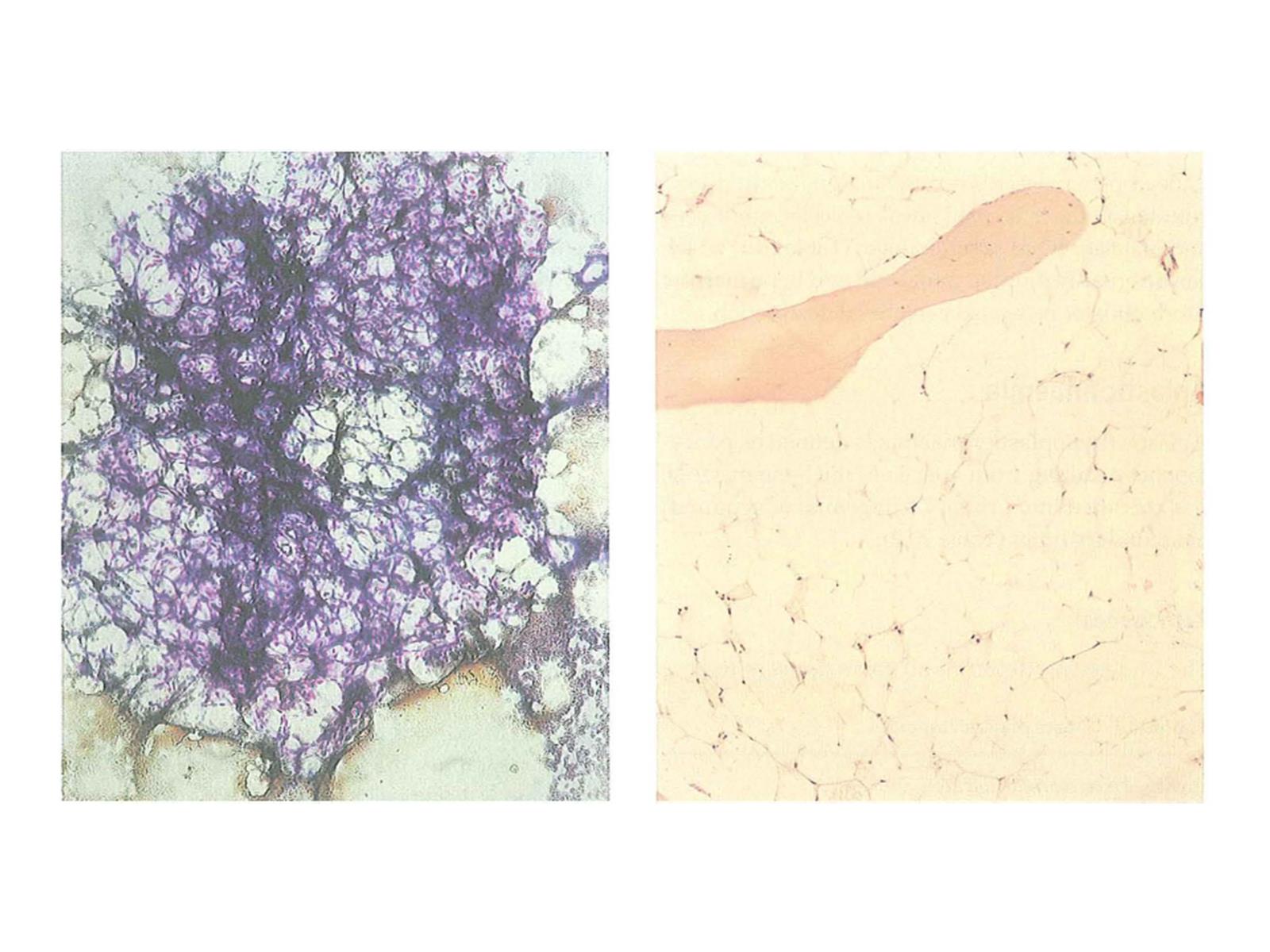 normocytic normochromic anemia.pptx on emaze