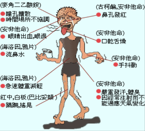 What Causes Stiff Neck Underlying Factors Mechanisms
