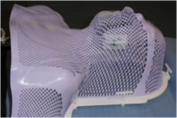 Radiothérapie Masque Thermoformé