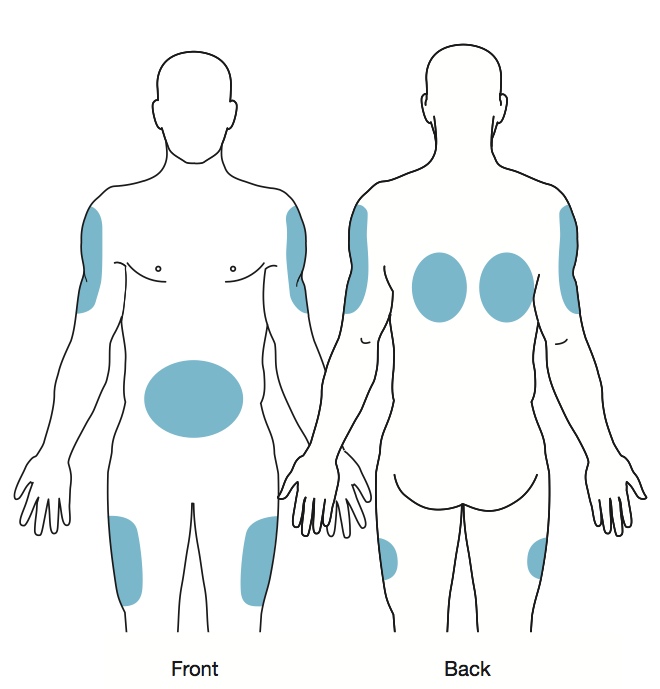 Subcutaneous administration visual data 3