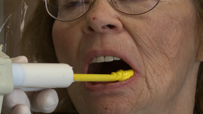 dental wax for broken tooth