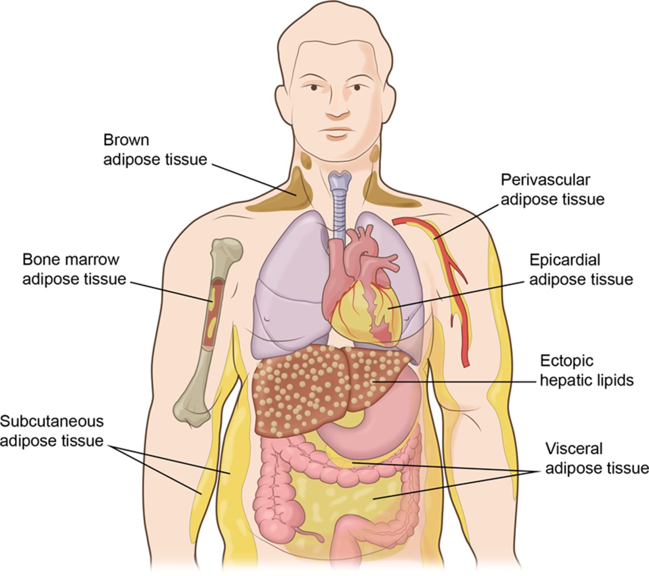 Mature fibroadipose tissue