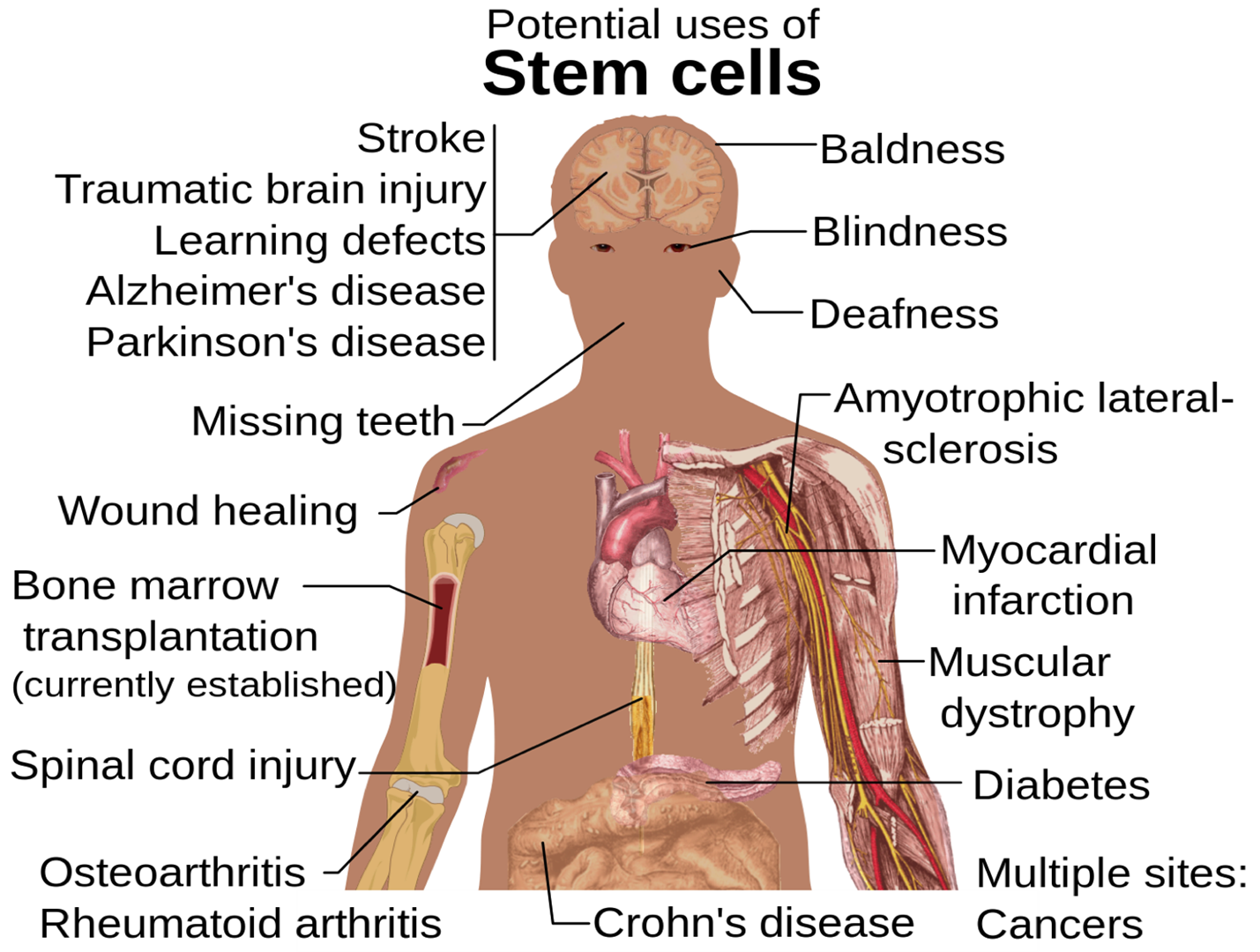 stem-cells-1-on-emaze