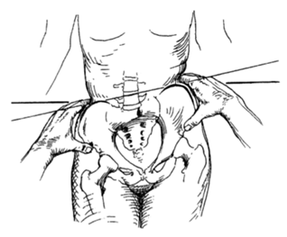 Exploraci N De Pelvis Y Cadera On Emaze