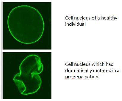 progeria cell diagram