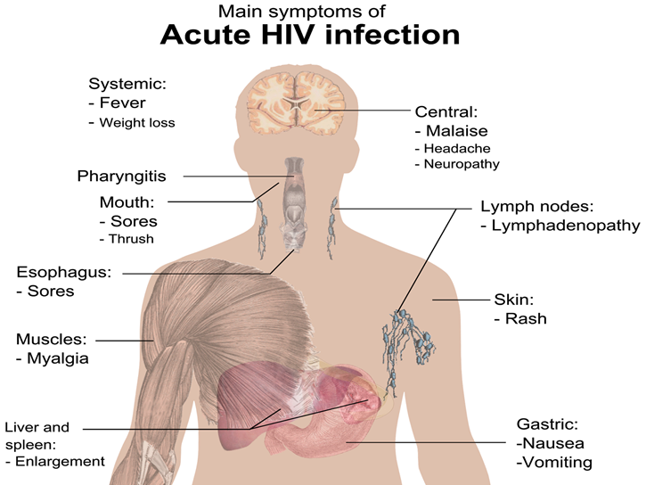 Симптомы Спида У Мужчин Фото – Telegraph