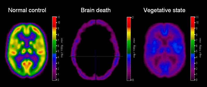 brain-death-on-emaze