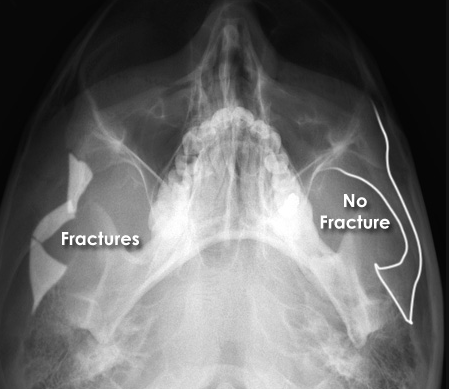 Facial Bones Xray tutorial on emaze