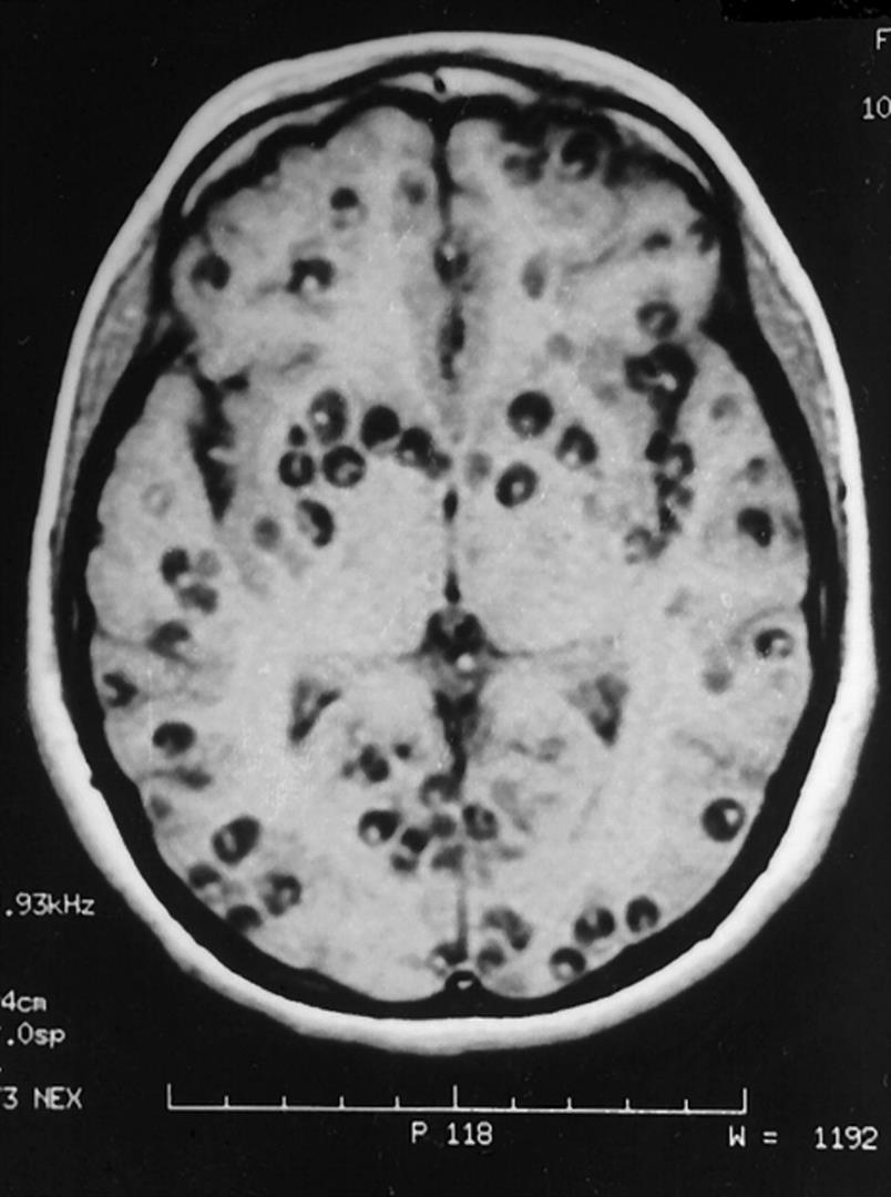 study-of-helminths-on-emaze