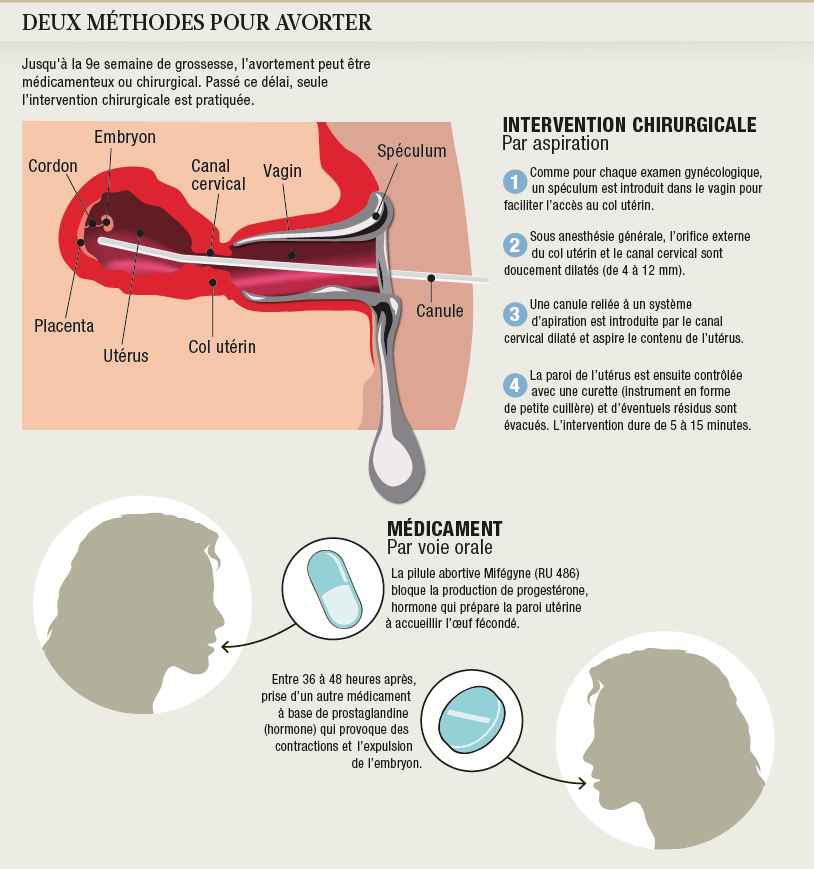 Contraception Contragestion Ivg On Emaze