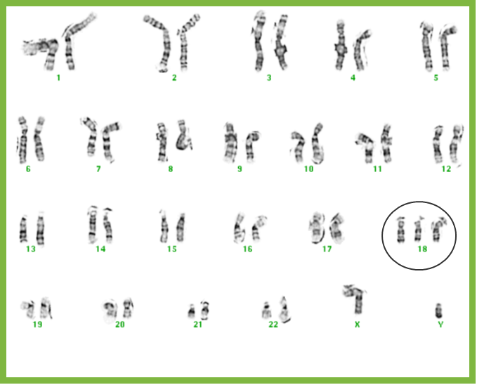 GENETICDISORDERS At Emaze Presentation