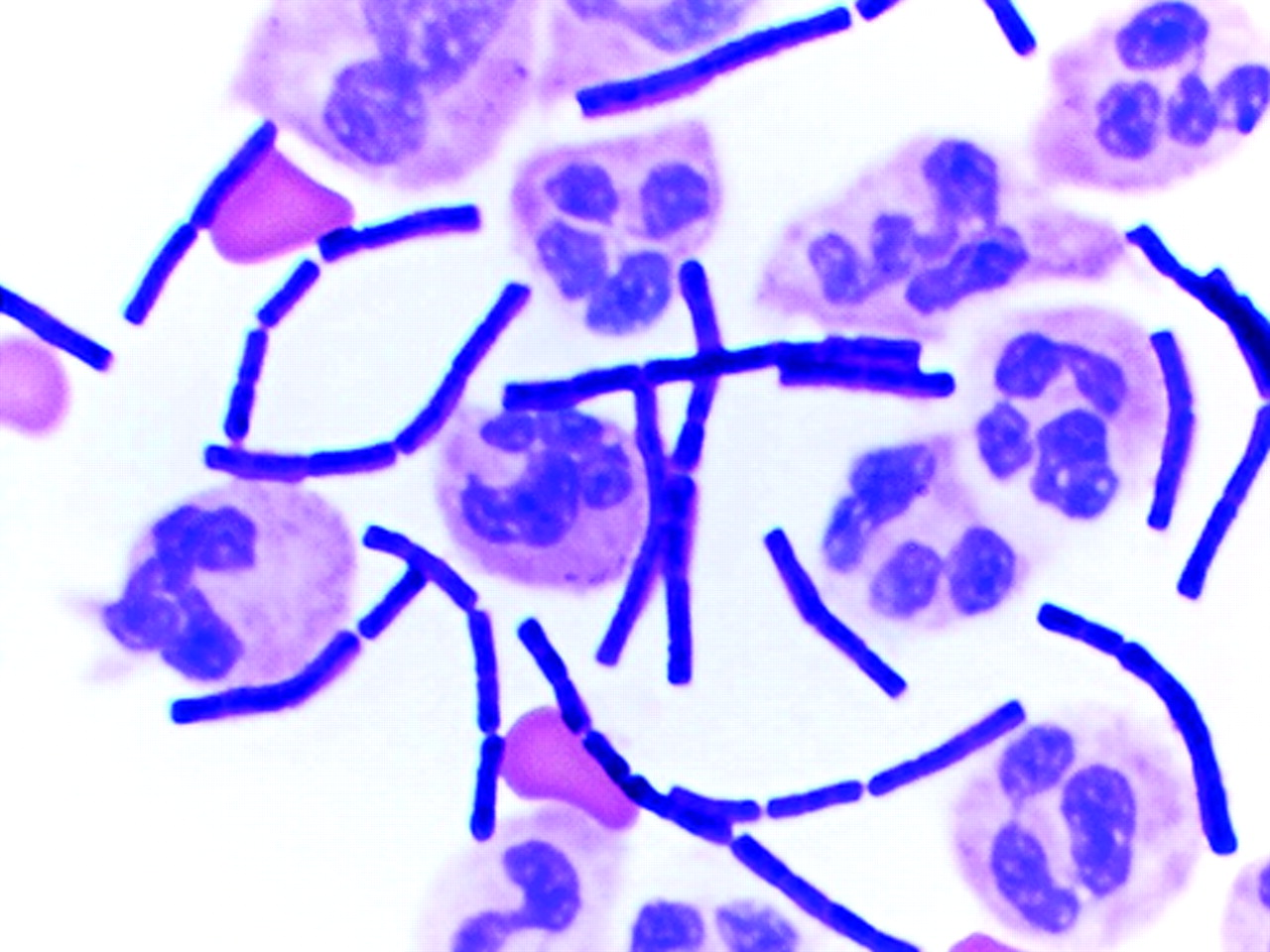 Bacillus anthracis микроскопия. Бацилла сибирской язвы Bacillus anthracis. Сибирская язва микроскопия.