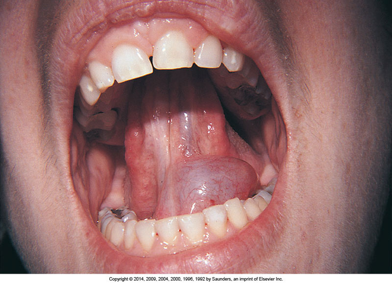 oral pathology Oral pathology clinical review 4 credit hours (4 ces) materials from united states air force 2013 instructional materials in the public domain for dental professionals. oral pathology Oral pathology clinical review 4 credit hours (4 ces) materials from united states air force 2013 instructional materials in the public domain for dental professionals.