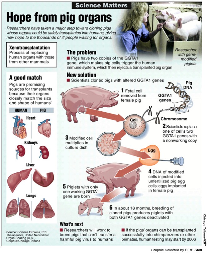 xenotransplantation persuasive essay