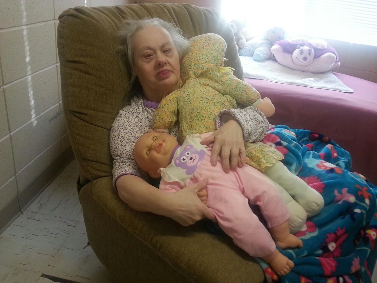 недоношенные детки с синдромом дауна. родила дауна. родила дауна. родила дауна. новорождённые дети с синдромом дауна.