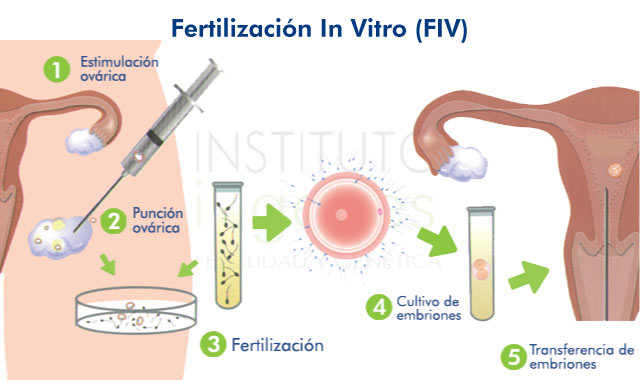 Embarazo in vitro que es