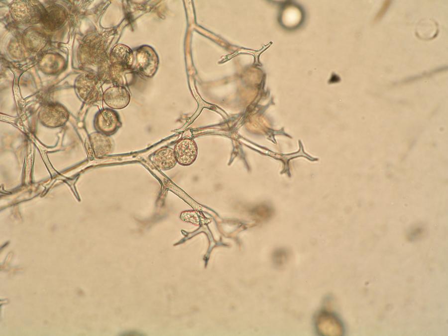 Возбудитель мучнистой. Конидии фитофторы. Конидии peronospora. Peronospora brassicae. Конидии мучнистой росы.