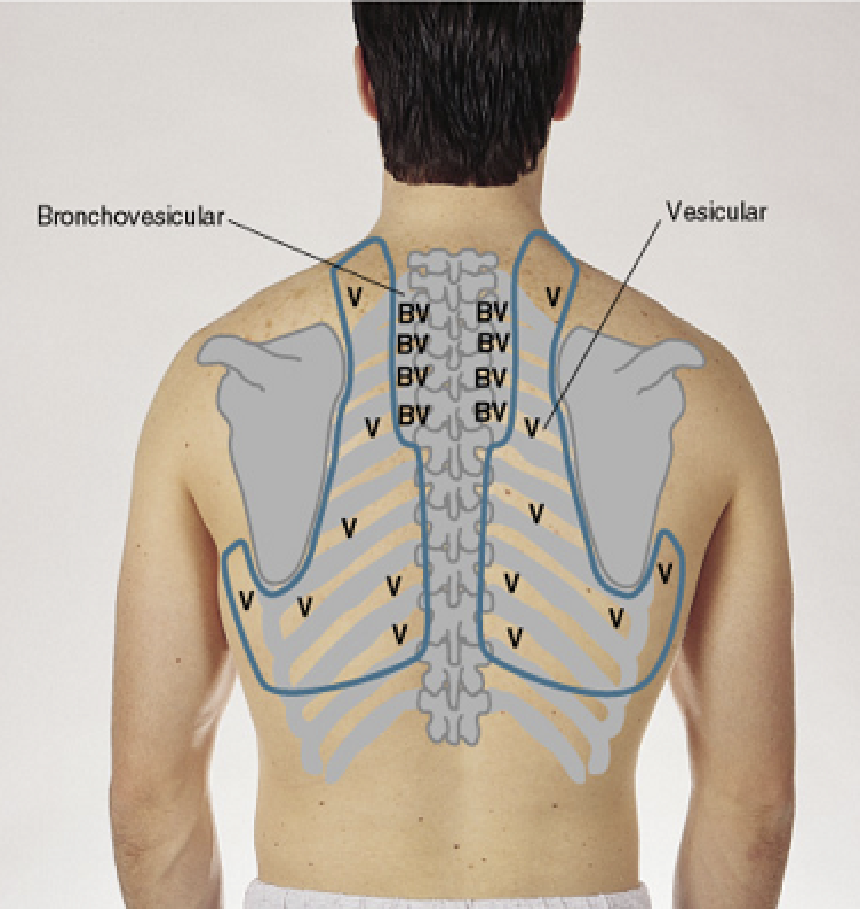 vesicular breath sounds