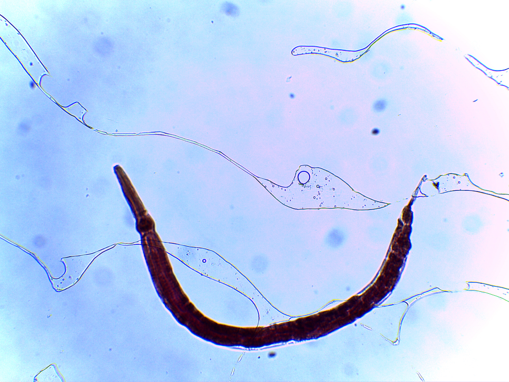 Enterobius vermicularis под микроскопом