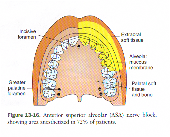 Maxillary Anesthesia -2.pptx on emaze