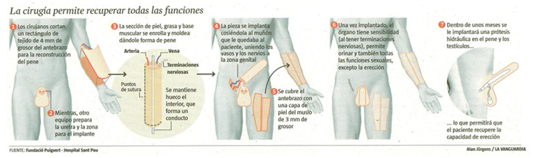 Como cocer el repollo para que no de gases