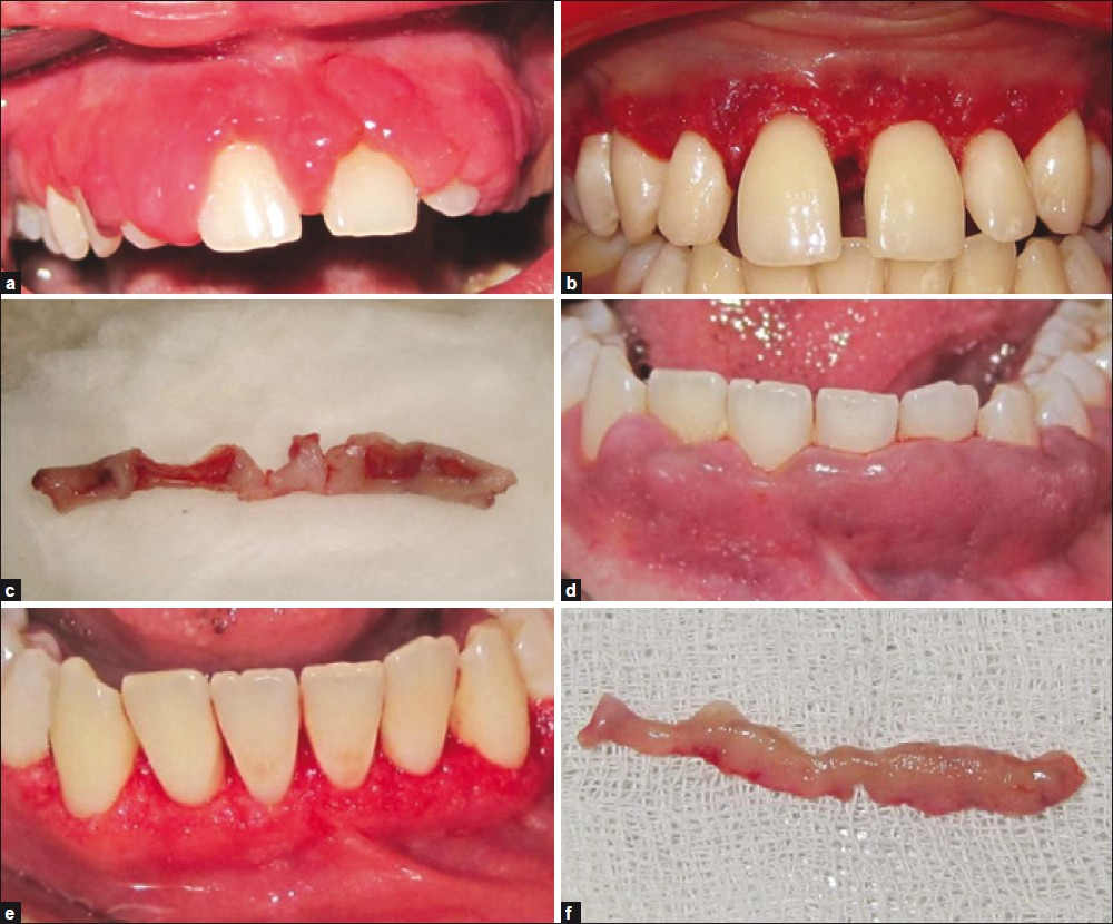 Surgical Treatment on emaze