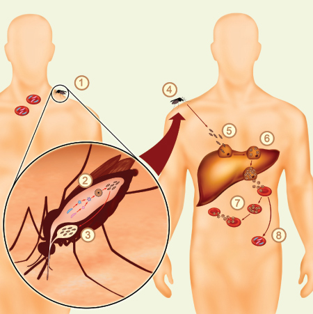 Тяжелое течение малярии ассоциируется чаще с возбудителем