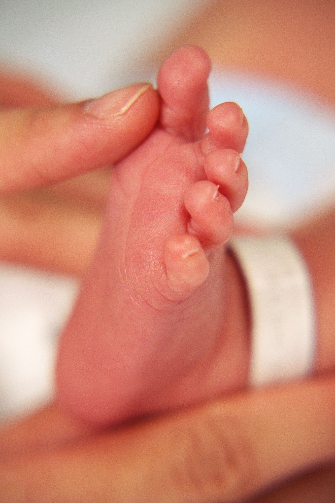 Малыш сильно потеет. Потные ручки и ножки у грудничка. Мацерация у новорожденных. Мацерация кожи новорожденного.