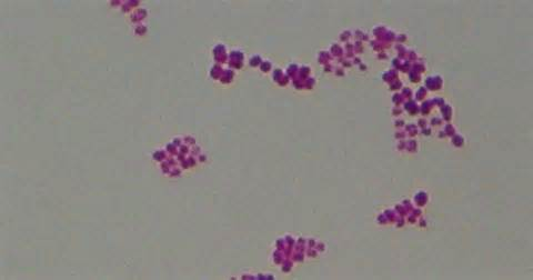Сарцины. Грамположительные кокки сарцины препарат. Сарцина Флава. Грамположительные кокки. Микрококки.. Сарцины микроскопия.