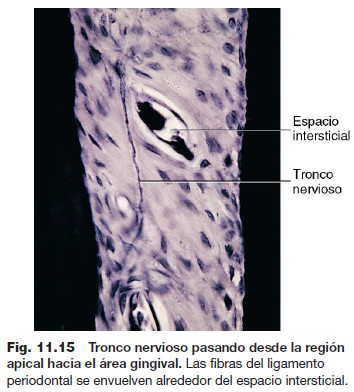 espacio del ligamento periodontal