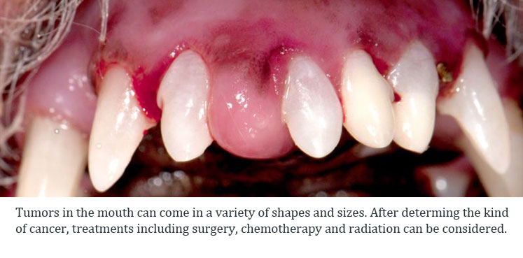 Tumor On Roof Of Mouth