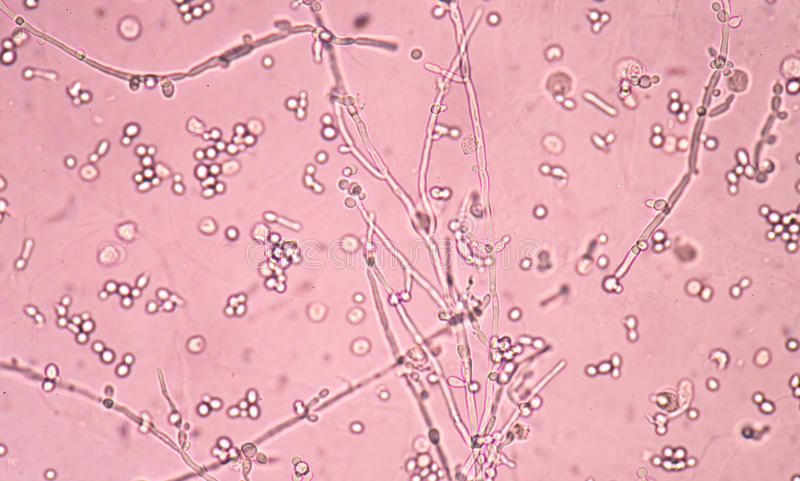 Дрожжевые клетки в моче повышены. Клетки дрожжей Соединённые цепочкой псевдомицелий. Дрожжевые клетки на руке. Дрожжевые клетки объектив 8х. Бактерии и дрожжи на коже собаки.