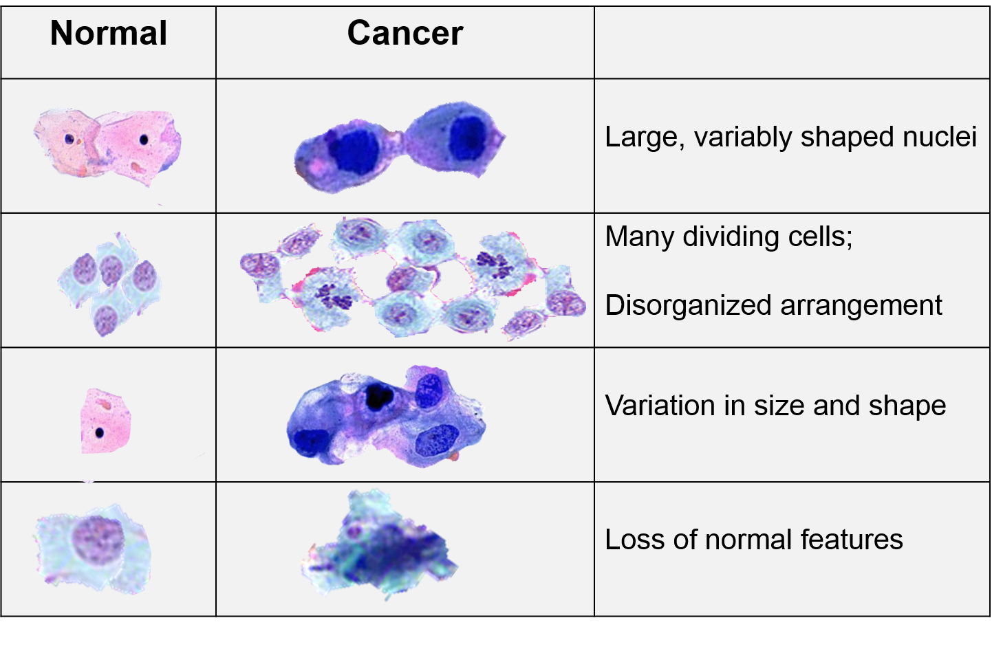 Cancer Cell. Cells their Shape and Size. A-Shaped Cells.