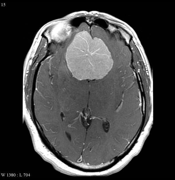 Orbitofrontal On Emaze