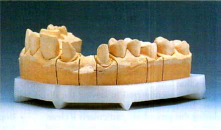 Рабочая модель. Отливка разборной комбинированной модели. Аппарат для сверления отверстий Giroform. Разборная рамка для зубных техников безштифтовых моделей. Зуботехническая система гипсовки моделей.