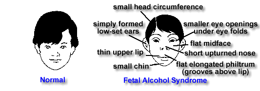 Small head. Small head circumference. Small head small head рисунок для детей. Small head на русском