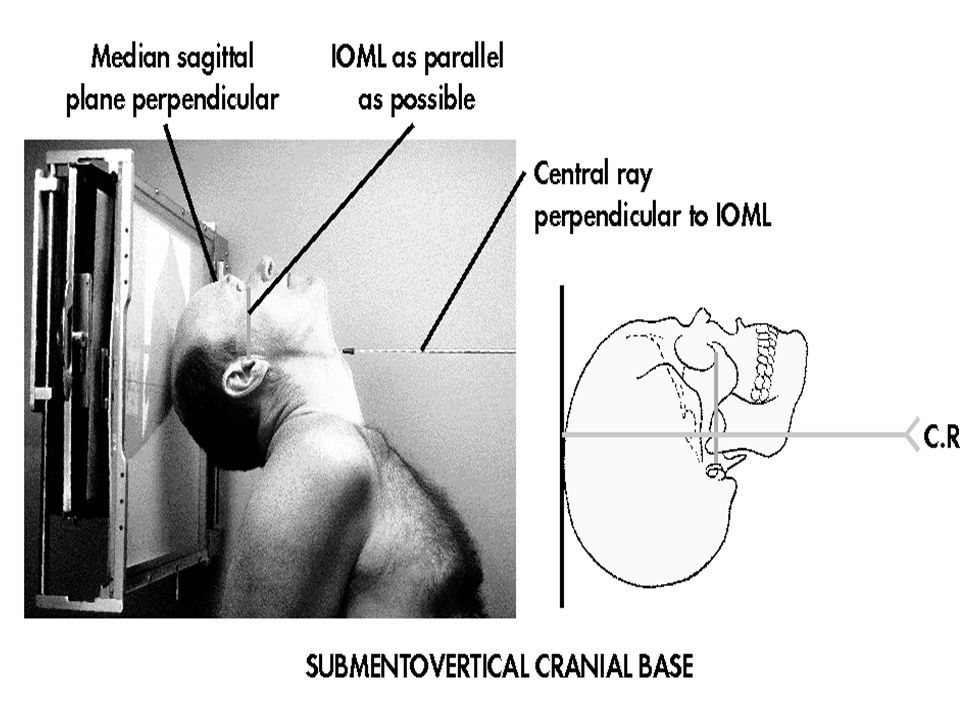 SUBMENTOVERTICAL on emaze