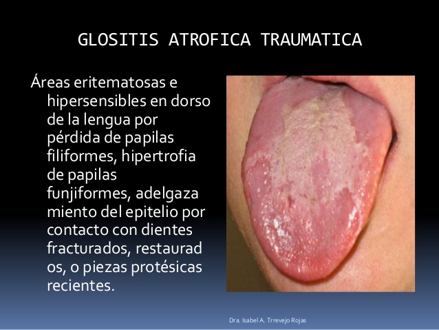 sentido del gusto on emaze
