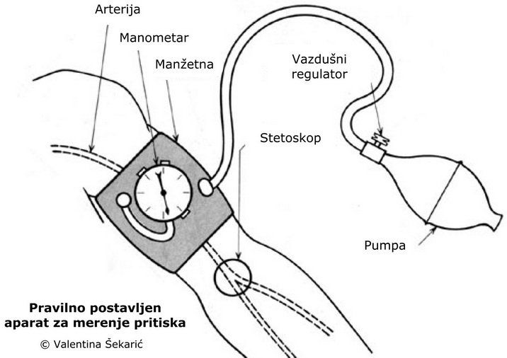 ARTERIJSKI KRVNI PRITISAK On Emaze