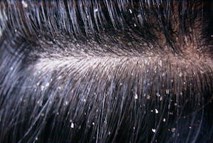 SCALP at emaze Presentation