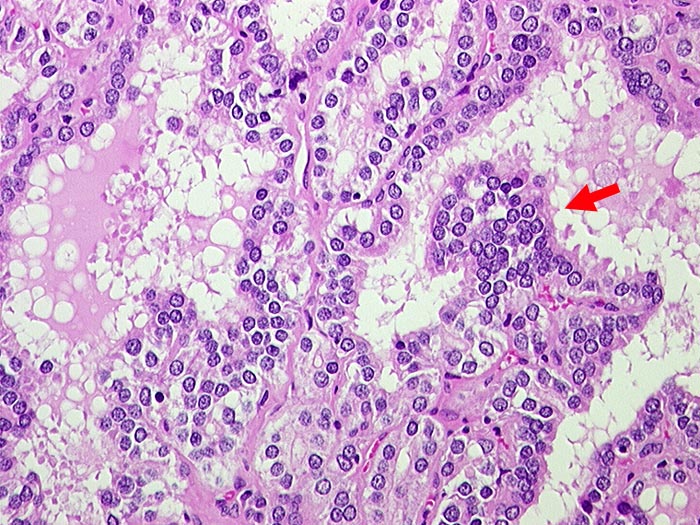 Endocrine 4th year Medicine lect. 2 (1).pptx on emaze