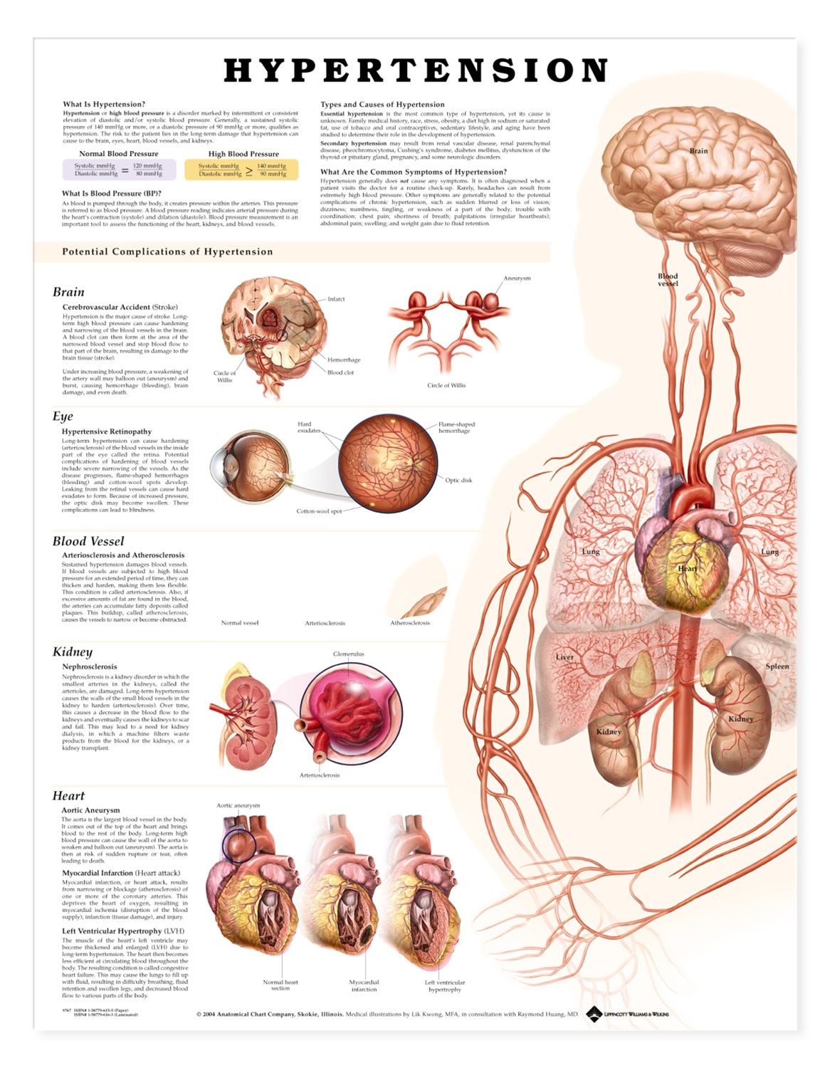 Hypertension at emaze Presentation