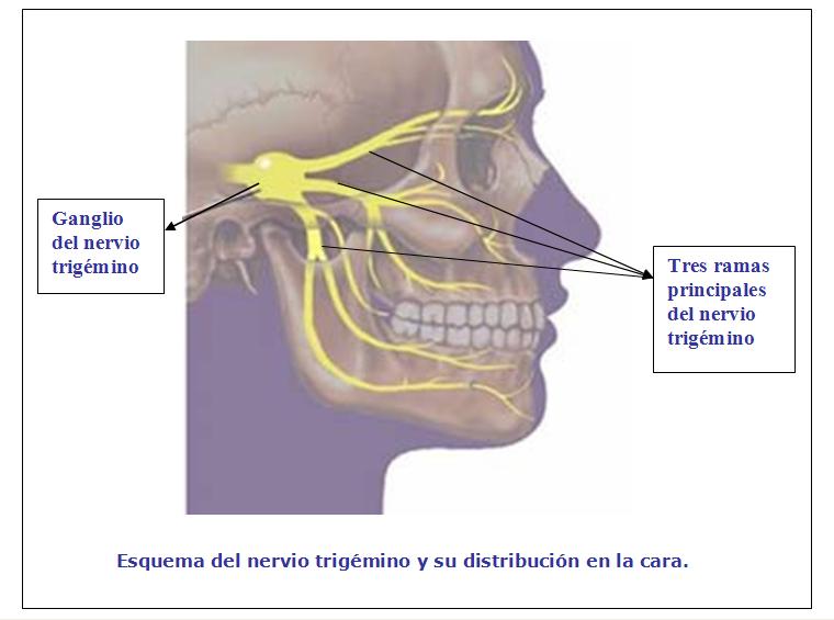 Тройничный нерв справа. Невралгия тройничного нерва нижней челюсти. Невралгия тройничного нерва схема. Тройничный нерв в челюсти. Блокада тройничного нерва.