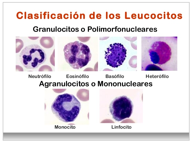 Leucocitos altos en orina que significa